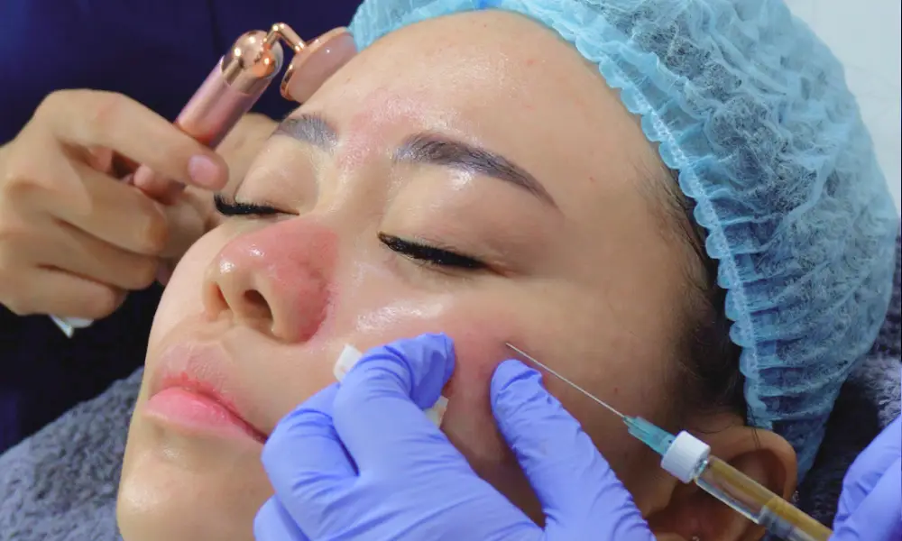 Filler Solusi Mengatasi Kerutan dan Meningkatkan Volume Wajah