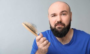 Tips Memilih Klinik Transplantasi Rambut