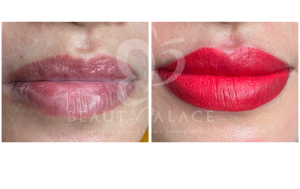 Before After Sulam Bibir Beauty Palace