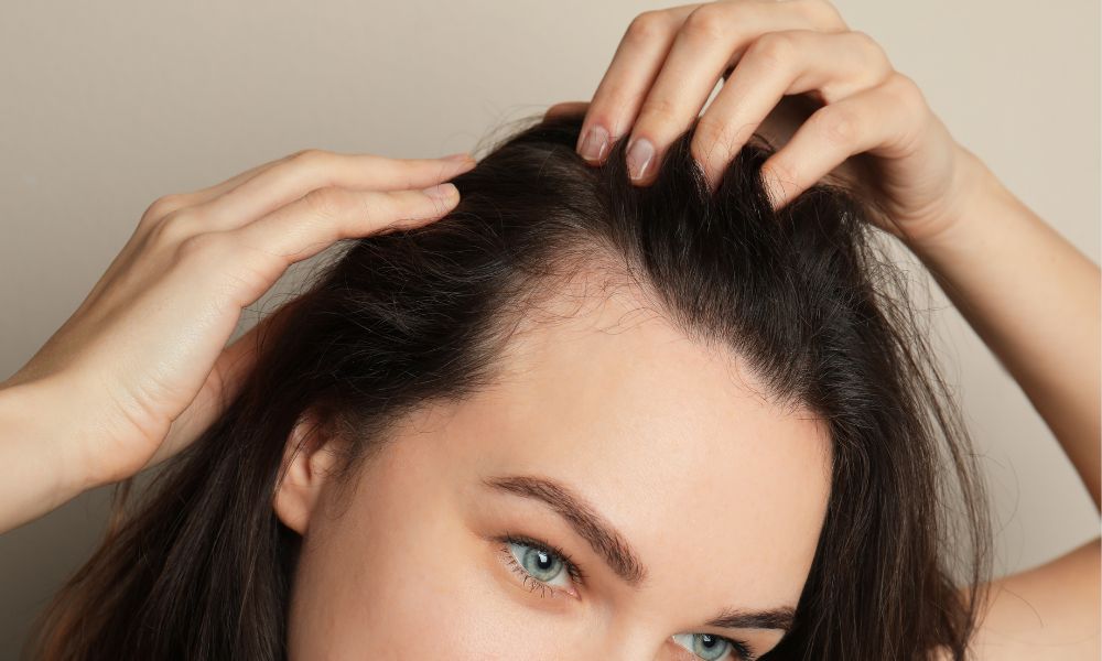 Hair Transplant untuk Wanita