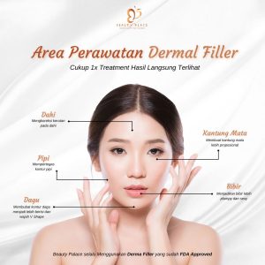 5 Titik Dermal Filler Populer untuk Wajah ( Beauty Palace )