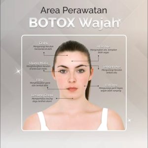 Area Perawatan Botox di Wajah