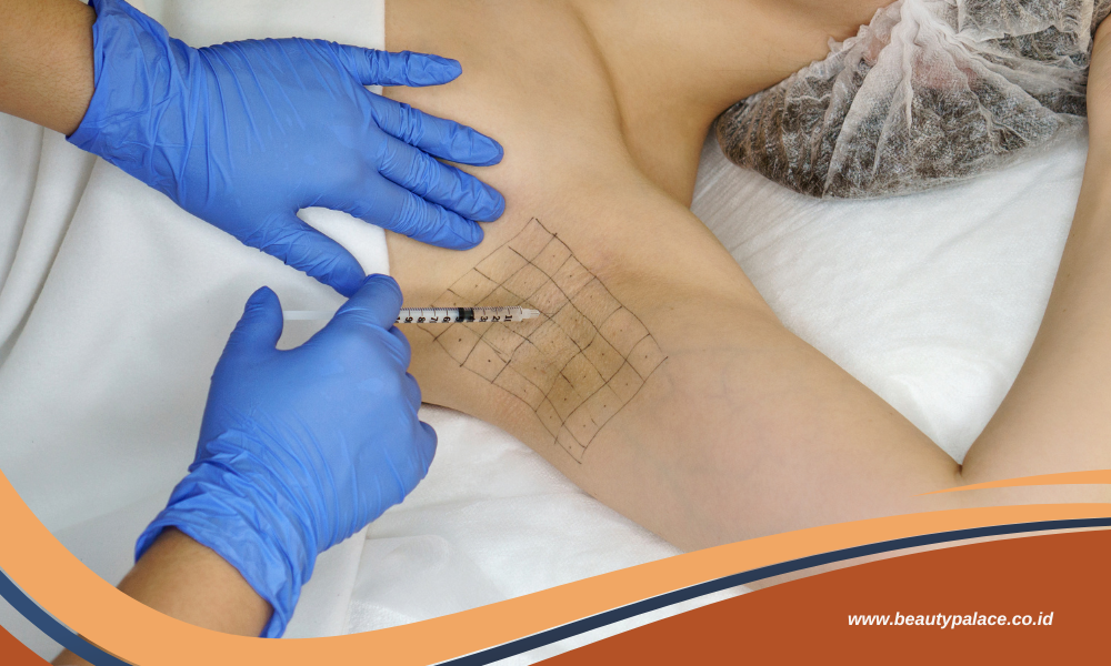 Botox Ketiak Bebas Keringat Berlebih dan Bau Badan Mengganggu